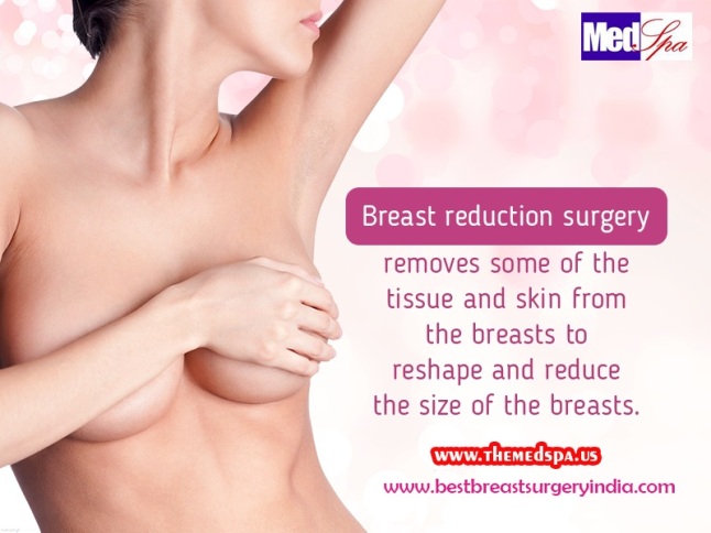 Breast Reduction Surgery to Reduce the Size of Breasts to Bring It in Proportion